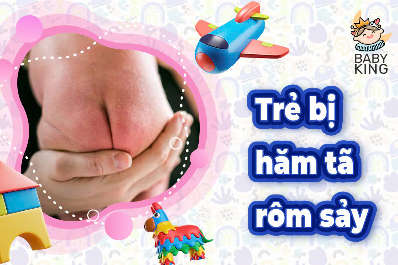 Trẻ bị hăm tã rôm sảy